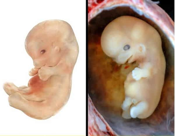 مراحل نمو الجنين بالصور 2