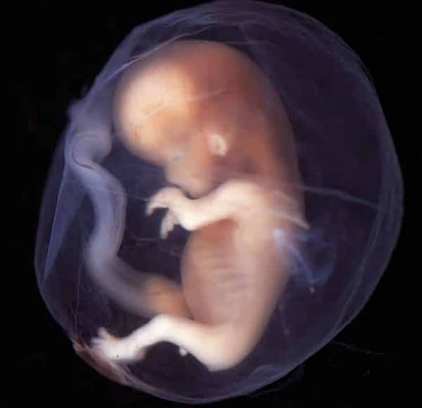 مراحل نمو الجنين بالصور 3