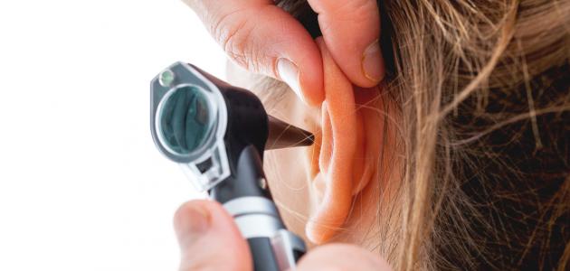 تجربتي مع ثقب طبلة الاذن- علاج ثقب صغير في طبلة الأذن