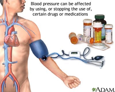 علاج نهائي لارتفاع ضغط الدم 