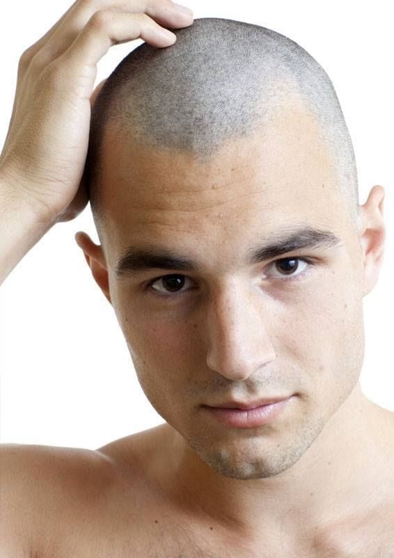 Does shaving hair with a razor cause baldness?