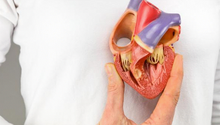 هل عملية القلب المفتوح تسبب الوفاة