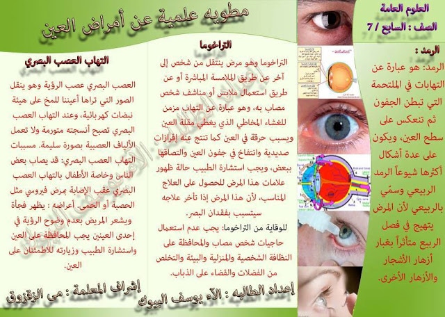 مطـويات عن صحة العين 6