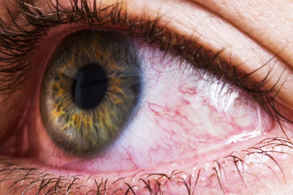 الغشاء الدموي في العين