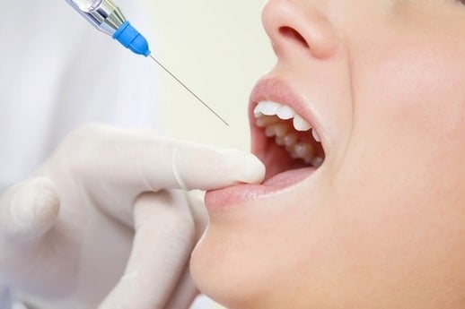 ازالة مفعول بنج الاسنان