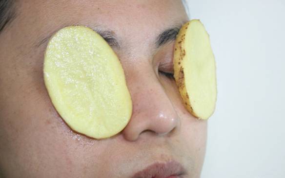 علاج كدمات العين بالبطاطس