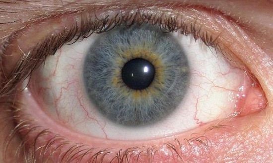 علاج انكماش شبكية العين