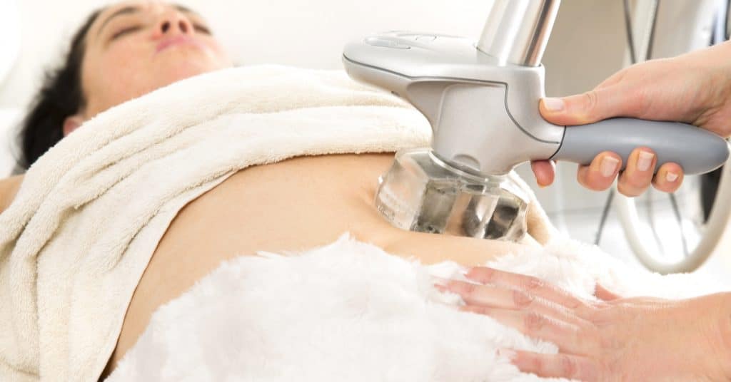 علاج تشققات البطن بعد الولادة بالليزر