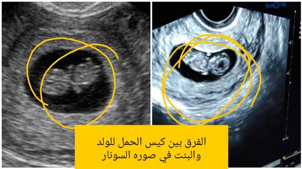 شكل كيس الحمل البيضاوي بالصور1