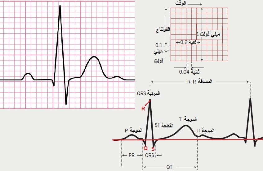 تخطيط القلب ECG