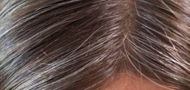 علاج شيب الشعر نهائيا وللابد في اقل من ساعة